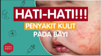 Infeksi Kulit pada bayi dan anak